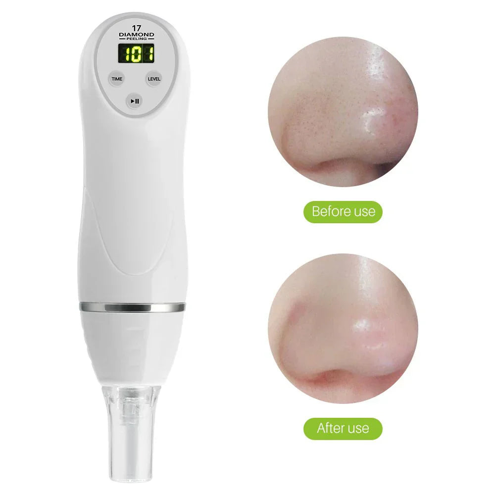 Electric Pore Suction and Acne Removing Device